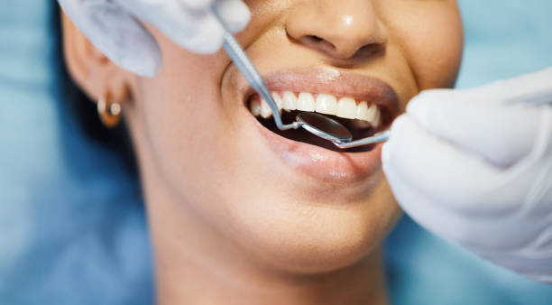 Best Emergency Broken Tooth Repair in Trevose, PA