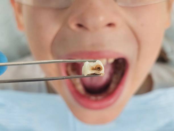 Best Emergency Dental Surgery in Trevose, PA